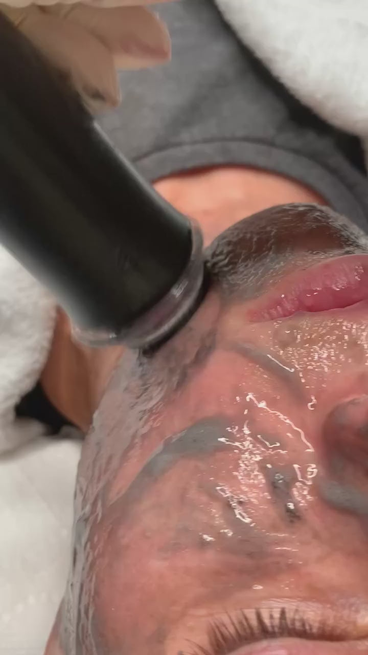 OxyGeneo Super Facial